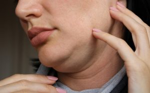 Read more about the article How Does Double Chin Removal Surgery Work?