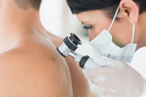 Read more about the article What you Should Know About a Full Body Skin Checks