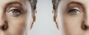 Read more about the article Top 3 Anti Ageing Sydney Treatments