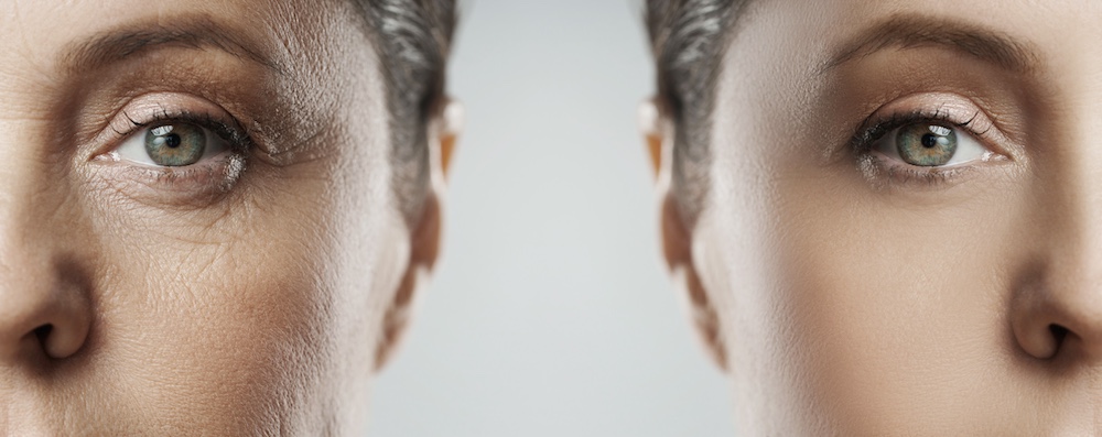 Read more about the article Top 3 Anti Ageing Sydney Treatments