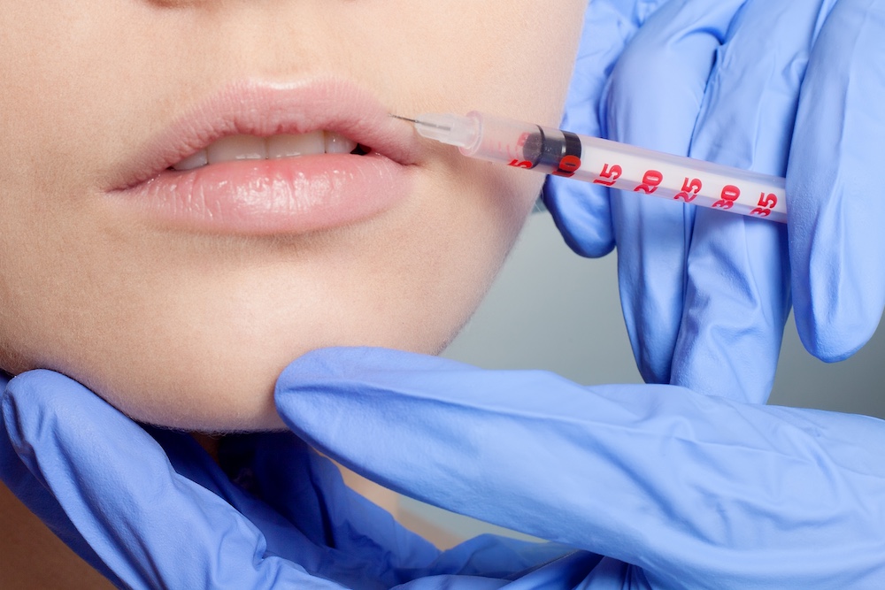 Read more about the article How to Get Rid of Smoker’s Lines